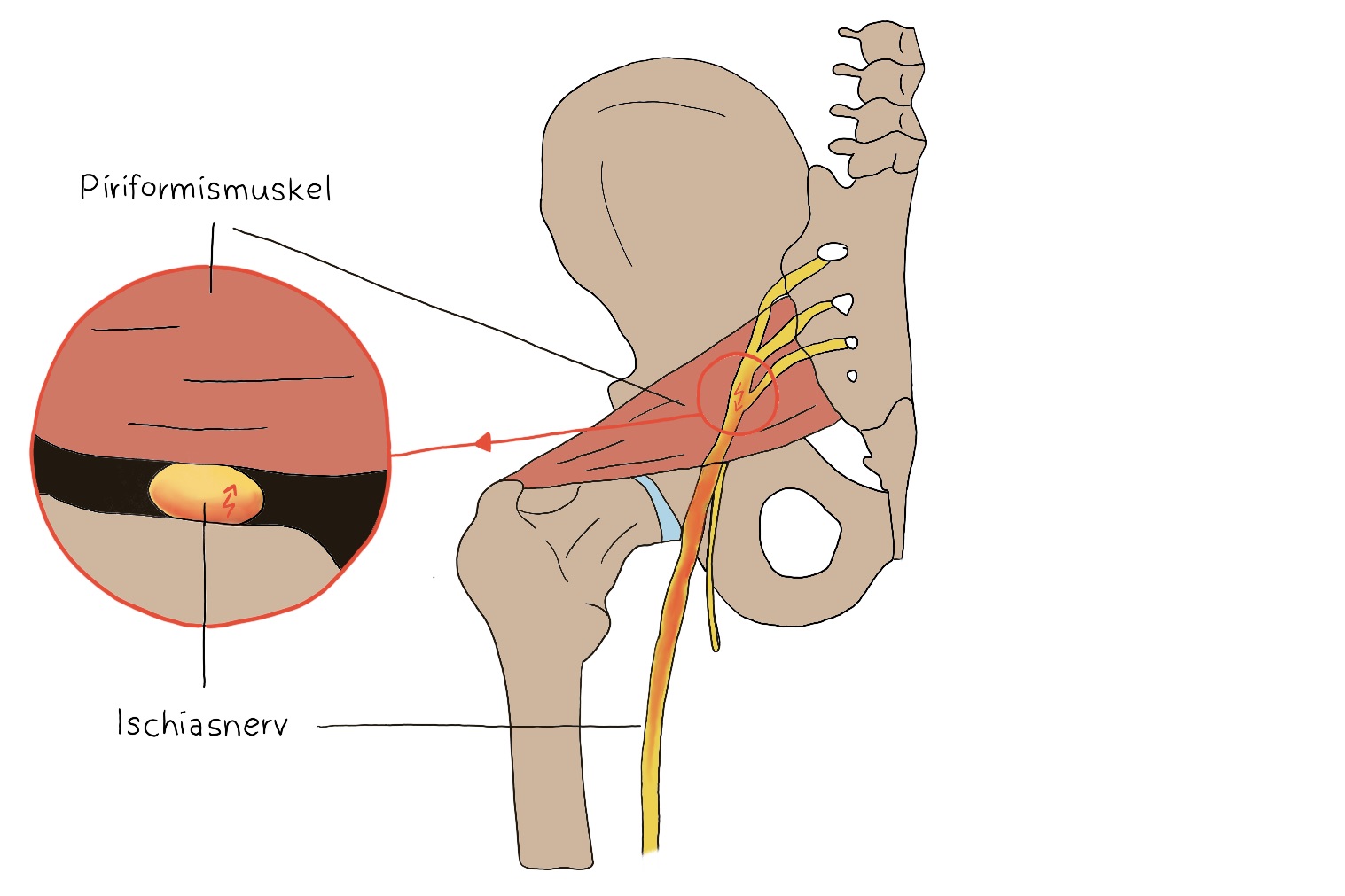 PiriformisSyndrom Physiotherapie & Osteopathie Beger Leipzig